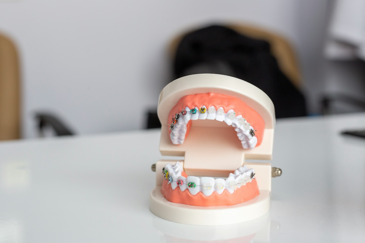 Tomograf CBCT în centrul de radiologie dentară Dental Alliance Roman